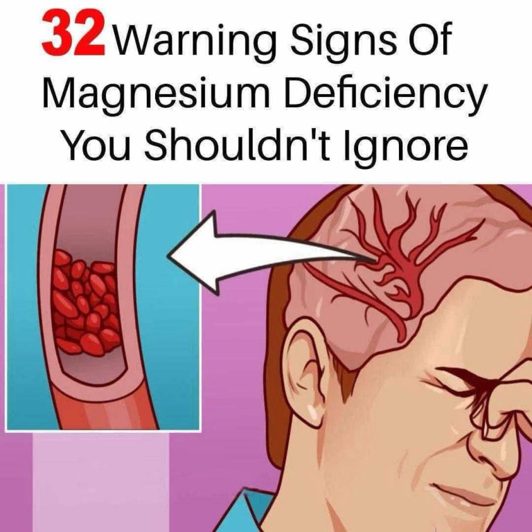 Signs of magnesium deficiency and foods to boost your levels