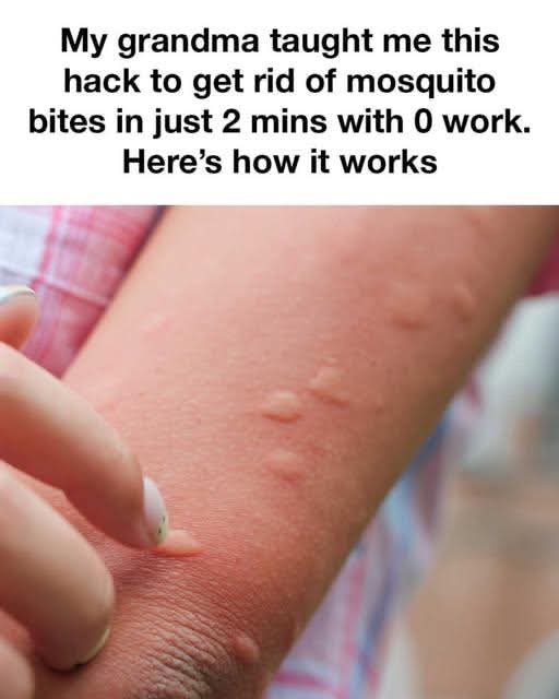 Doctors caution against viral hot spoon mosquito bite remedy