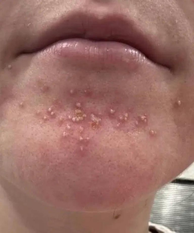 Be careful! These are the consequences of sleeping with the…