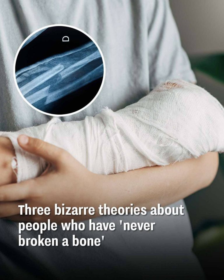 Bizarre theories about people who have ‘never broken a bone’
