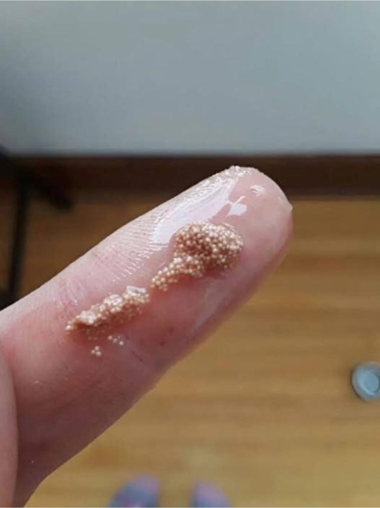 I found slimy lumps in an egg and thought they were insect eggs