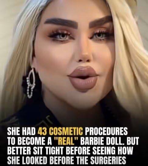 43 Surgeries to Look Like a Doll Spark Controversy