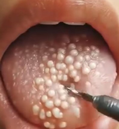 These are the consequences of eating …See more