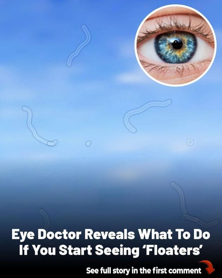 What Are Eye Floaters? Here What To Do If you Start Seeing Them