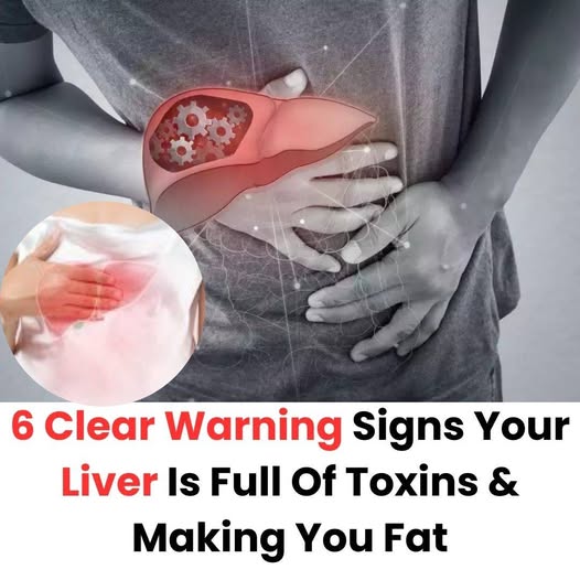 6 Clear Warning Signs Your Liver Is Full Of Toxins & Making You Fat