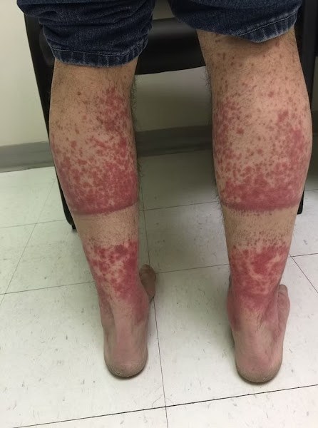 These are the consequences of sleeping with the… See more