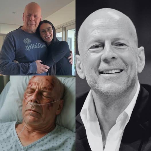 Family confirmed that former actor Bruce Willis had!