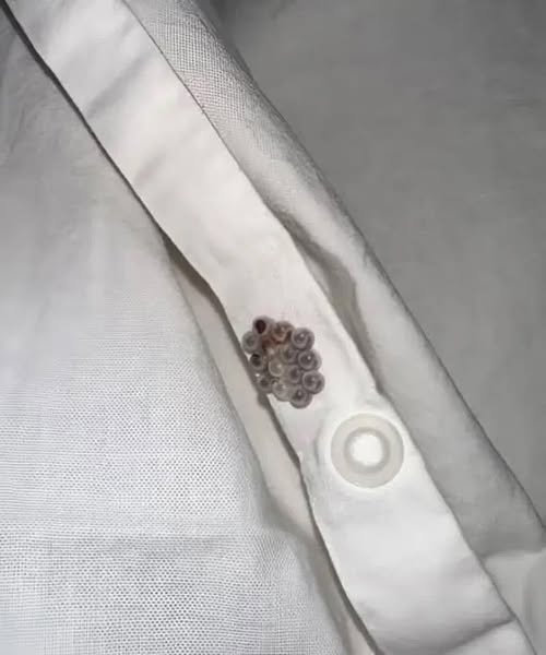 A Shocking Discovery in My Bed Turned Into a Wake-Up Call About Hidden Home Dangers