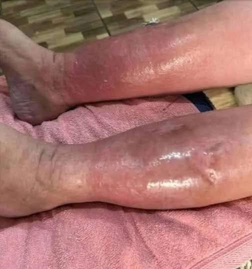 These are the signs that he is cr… See more👨🏻‍🦽‍➡️