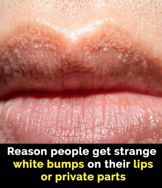 Reason behind strange white bumps found on your private parts