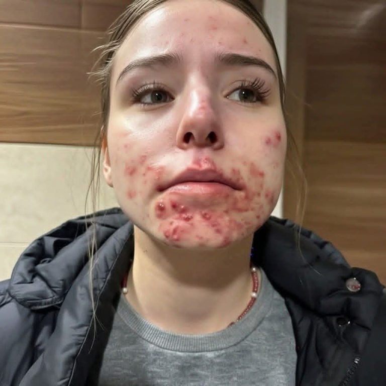 His body was itchy, he thought it was an allergy