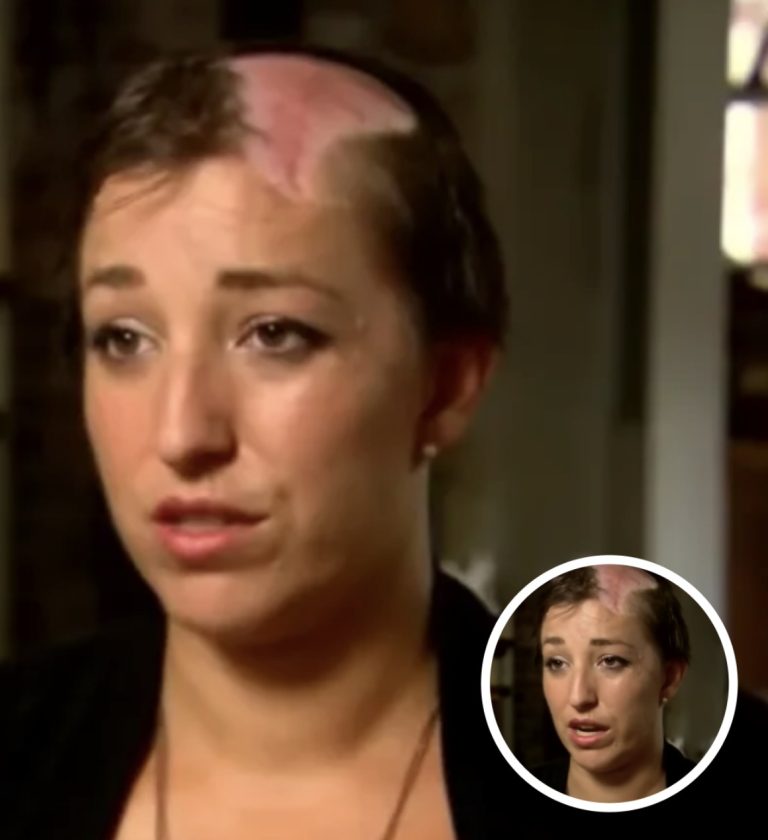 Mom Of 4 Scalped Seconds After Making Simple Mistake, Sends Warning To All Other Women