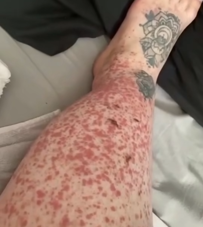 These are the consequences of sleeping with…See more