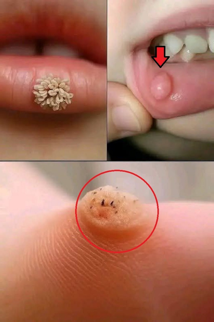 These are the first signs of an enf