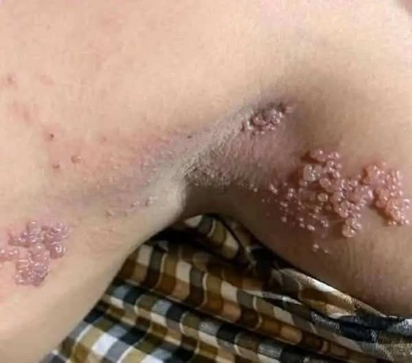 These are the consequences of sleeping with the…See more