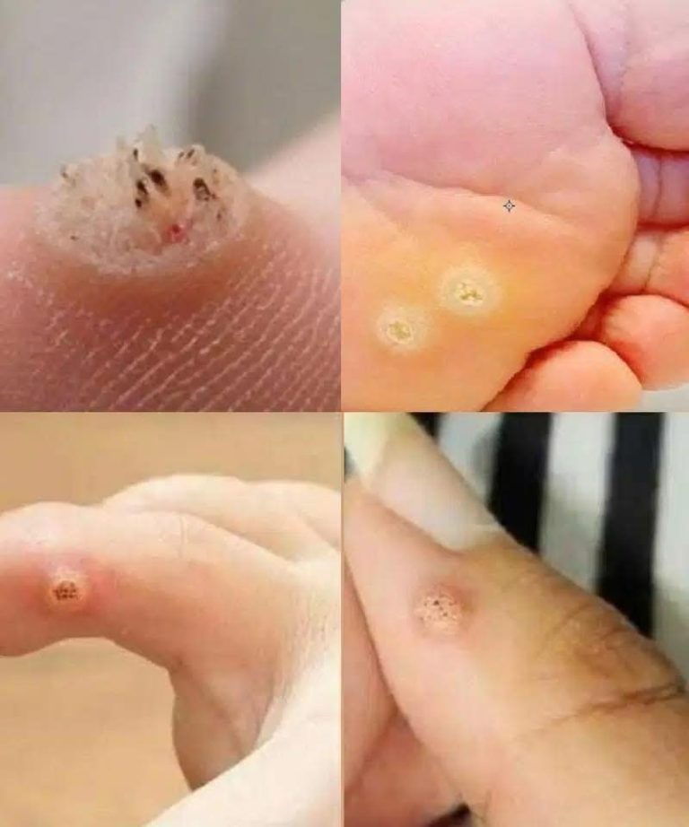 Be Aware: If You Notice These Skin Changes, See a Dermatologist