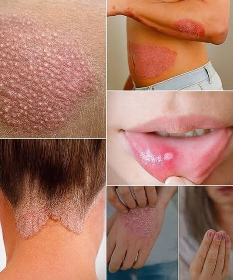 Signs you should know if you have this thing called da…