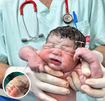 Photo Of Newborn Baby Turns Heads After People Spot Small Detail