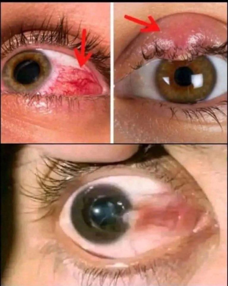 Did you know that your eyes are warning you if… See more