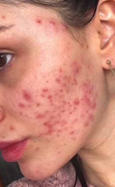 The Unseen Costs of Intimacy with the Wrong Partner: Emotional, Social, and Health Implications