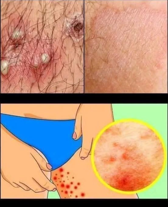 THESE ARE THE SIGNS THAT IT IS CR, SEE MORE!!!?