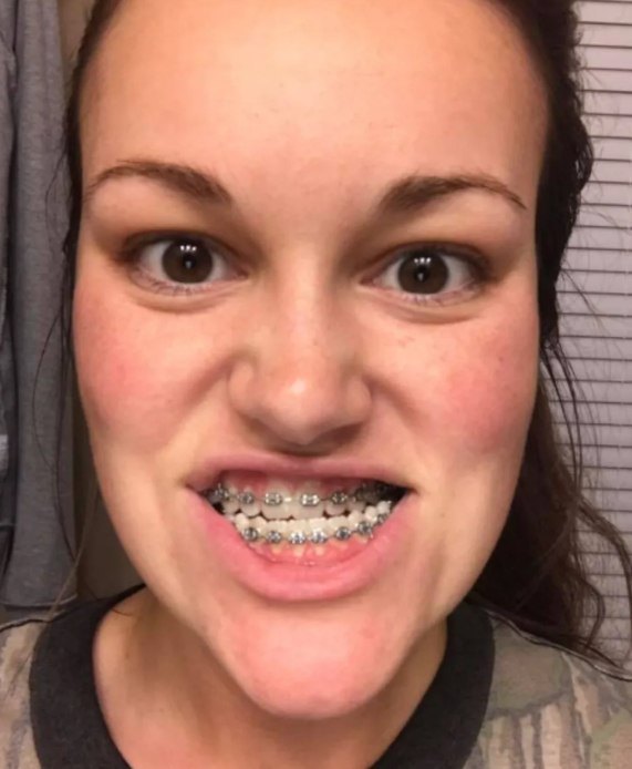 Her Post-Surgery Struggle Was Real—But Her Glow-Up Is Even More Powerful!