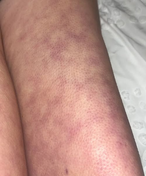 ‼️These are the consequences of sleeping with the… 😲👇