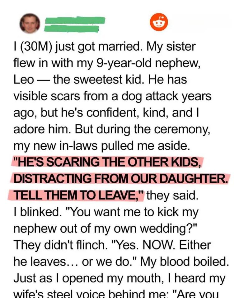 My In-Laws Tried to Ban My Scarred Nephew from Our Wedding — My Wife’s Response Left Them Speechless
