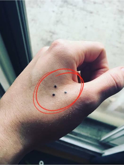 The ‘three-dot tattoo’ – potential meaning and significance