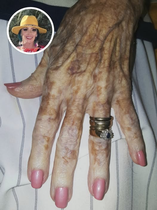 Woman Takes Photo Of Old Lady’s Hand After Manicure, Notices Detail That’ll Make You Tear Up