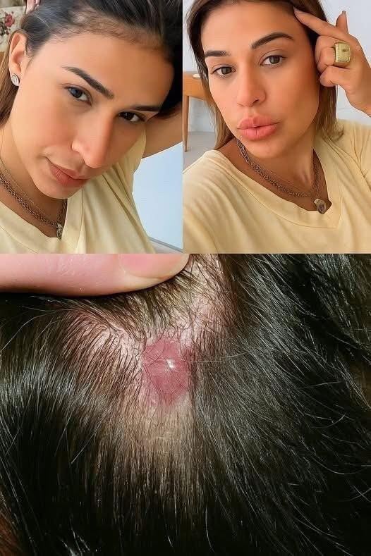 She is taken to the hospital and the diagnosis is revealed. She has… See more