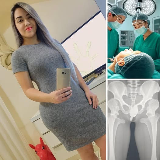 Girl had to be hospitalized for wanting to use a pe…See more