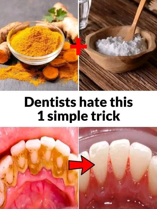 How to Remove Tartar and Plaque from Your Teeth Without a Dentist: Turmeric and Salt