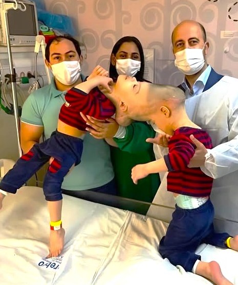 These brothers from Brazil were born with their heads fused together and had to share not only vital blood vessels but also parts of their brains.