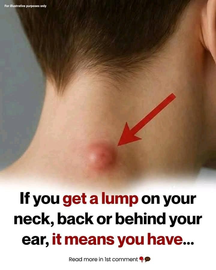 If you get a lump on your neck, back or behind your ear, it means that…