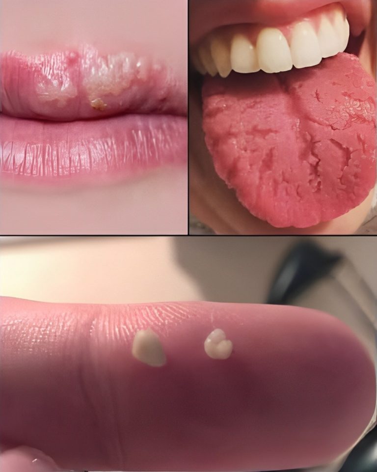 Your mouth says a lot about your health; these symptoms warn you about a dog