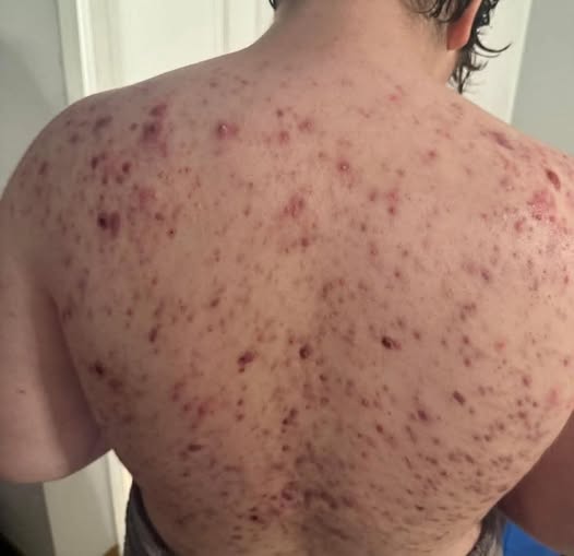 These are the consequences of sleeping with the