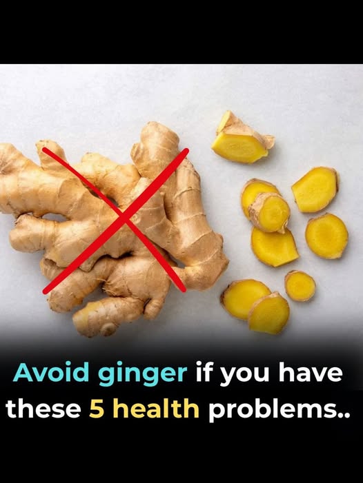 Avoid Ginger If You Have These 5 Health Problems – What You Need to Know
