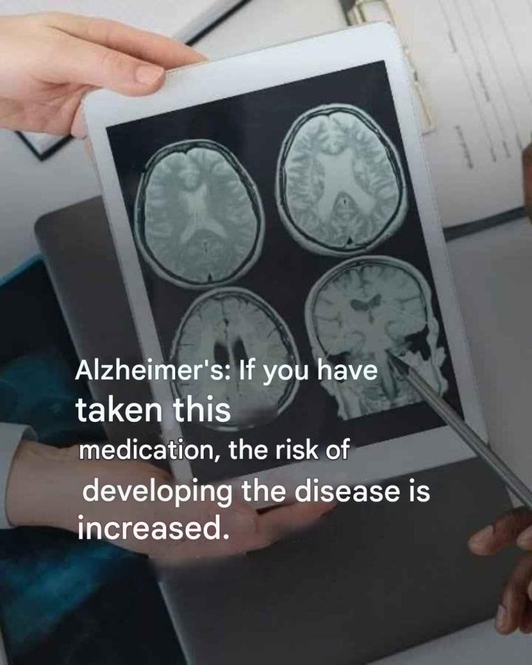 Alzheimer’s: These 6 habits increase the risk without you knowing it