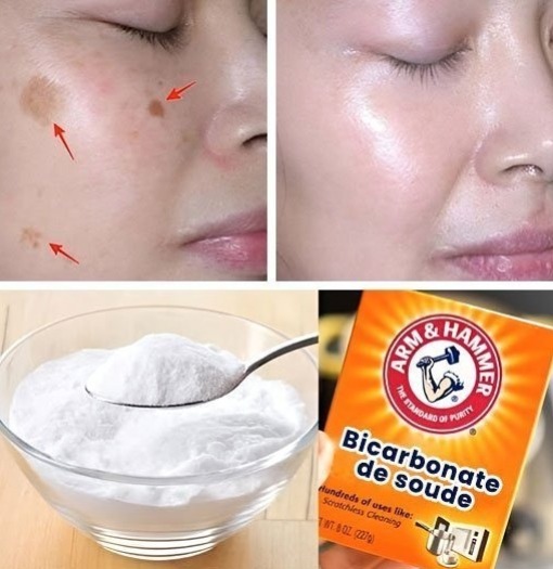 ✨ 4 Ways to Erase Age Spots with Baking Soda for Younger, More Even Skin