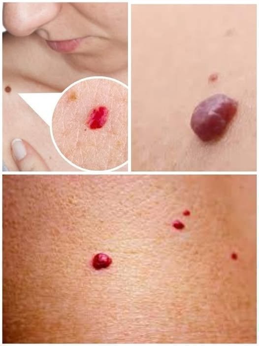 f You Spot These Red Dots on Your Skin, Here’s What They Mean ❤️🩺