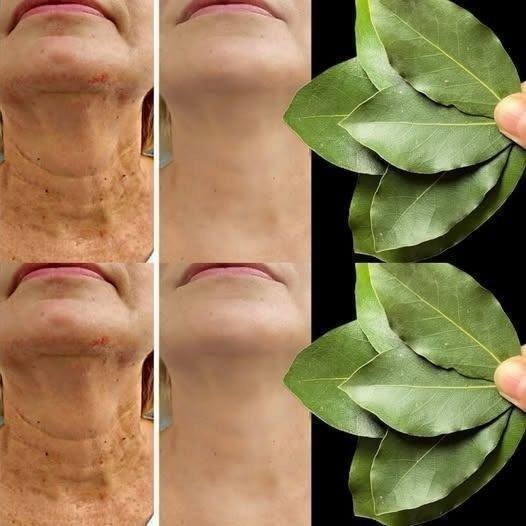 🌿 What Bay Leaves Actually Do for Skin (The Truth)