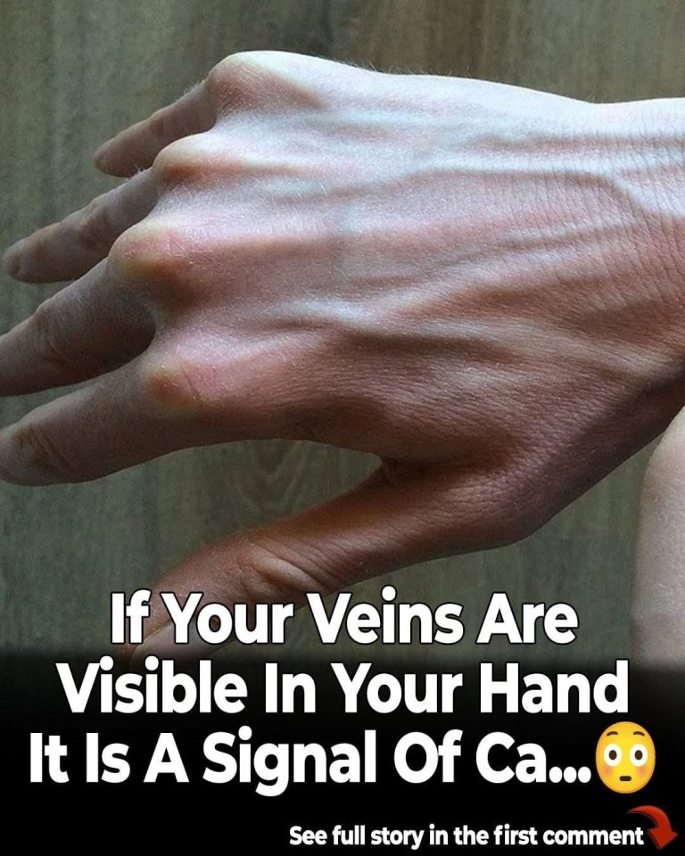 Why Your Veins Appear More Prominent Overnight