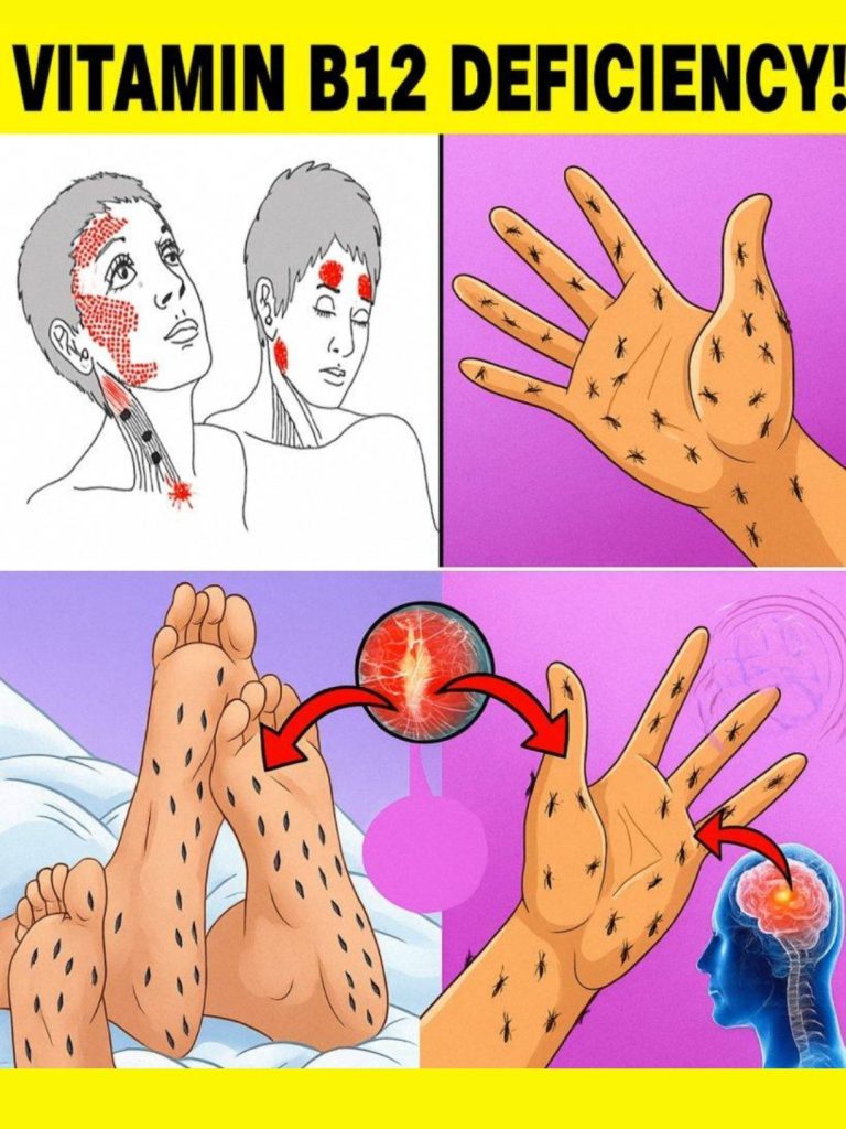 Vitamin B12 Deficiency Symptoms That Should Never Be Ignored 🚨