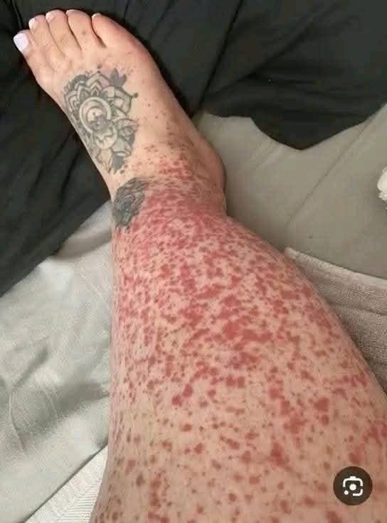 Here are the consequences of sleeping with…