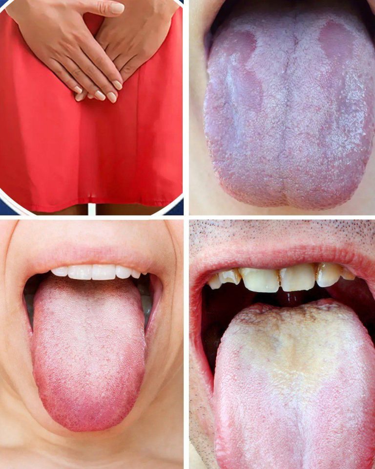 What your tongue can tell you about your health: 5 symptoms