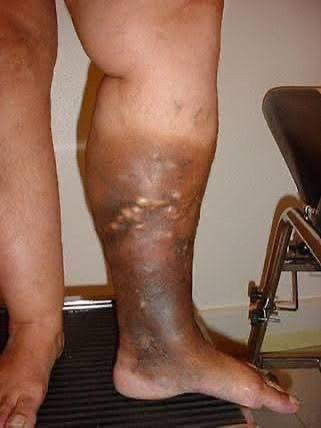 These are the first symptoms of cr…