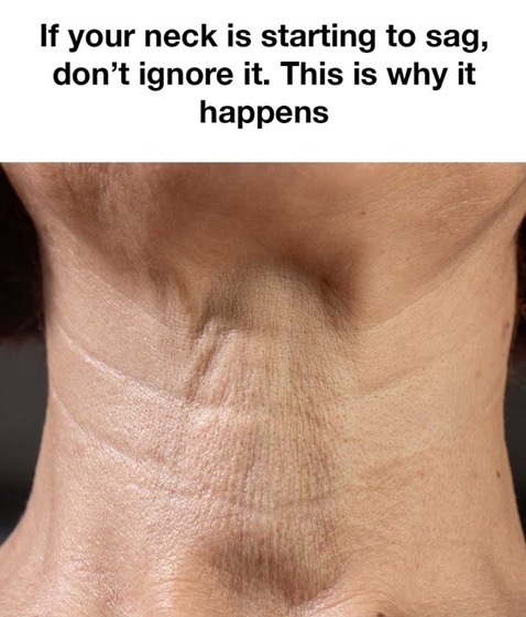 If your neck is starting to sag, don’t ignore it. This is why it happens