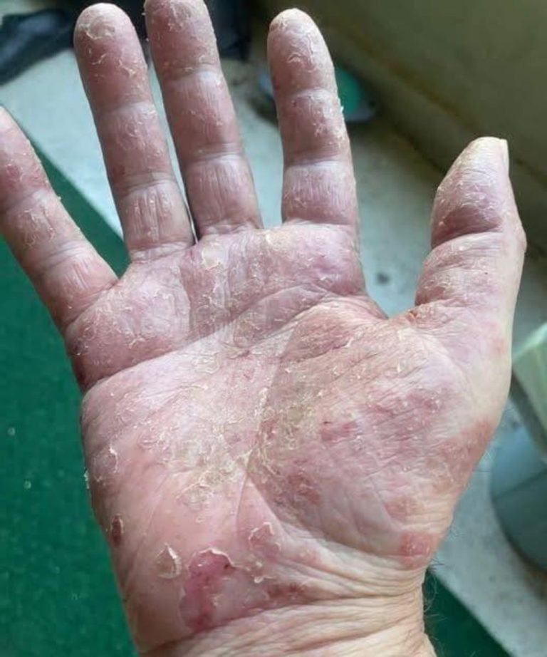 These are the signs that he is ra…