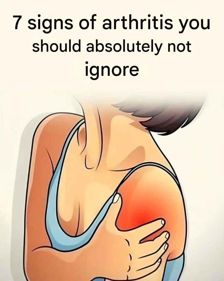 7 little-known symptoms of arthritis that you shouldn’t ignore